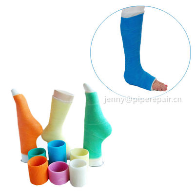 Fiberglass casting tape for plastic surgical fractures and sprains of external fixation