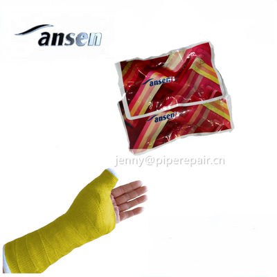 15cm 360cm Fibreglass casting tape Hospital Use resin fixation bandage Medical Fiber Bandage / Orthopedic Casting Tape