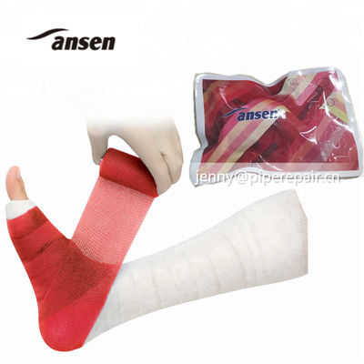 Fiberglass casting tape for plastic surgical fractures and sprains of external fixation