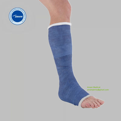 fiberglass casting tape epoxy resin ortopedic bandage water activated polyurethane resin fiberglass wrap