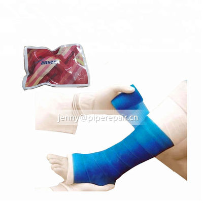 Medical fiberglass casting tape for Fracture External Fixation with Competitive price with surgical gloves