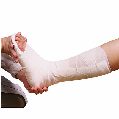 Excellent Ventilation Medical Bone Fracture Molding Orthopedic Fiberglass Casting Splint