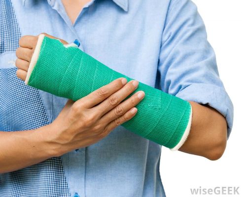 Orthopeidc Polyurethane Resin Water Activated fiberglass synthetic casts