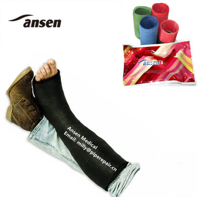 Hospital Orthopedic Consumables Water Activated Fiberglass Cast Medical Gypsum Bandage