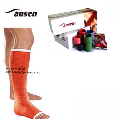 2025 Trends Hospital Consumables Medical Gypsum Bandage Colorful Fiberglass Casting Tape