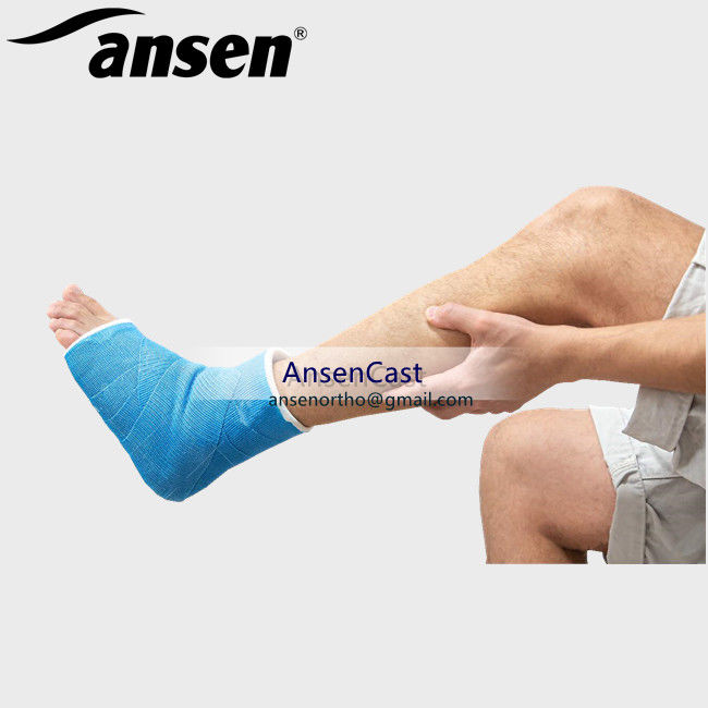 Arm Medical Bandage Orthopedic Fiberglass Cast Fabric Colored Casting Bandage Fiberglass Casting Tape